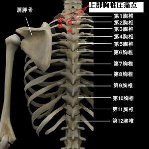 �㕔���ł̈��ɓ_�}��