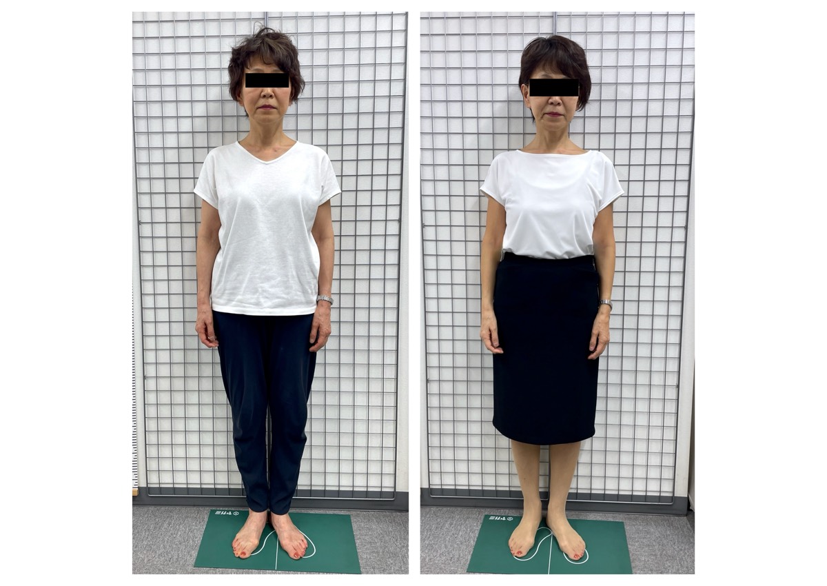 ダイエット卒業 60代女性の画像